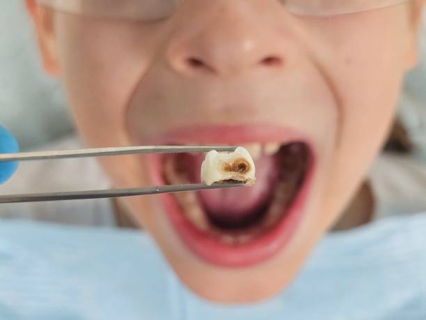 Best Emergency Broken Tooth Repair in Navesink, NJ