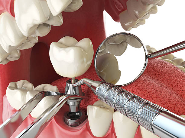 Best Emergency Tooth Extraction in Navesink, NJ